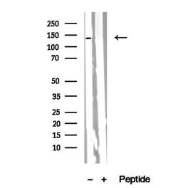 Invitrogen PER2 Polyclonal Antibody 100 &mu;L; Unconjugated:Antibodies,