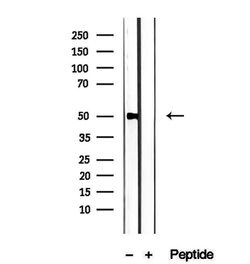 Invitrogen PMPCB Polyclonal Antibody 100 &mu;L; Unconjugated:Antibodies,