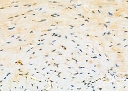 Invitrogen MGRN1 Polyclonal Antibody 100 &mu;L; Unconjugated:Antibodies,