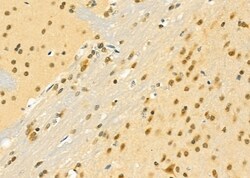 Invitrogen MGRN1 Polyclonal Antibody 100 &mu;L; Unconjugated:Antibodies,