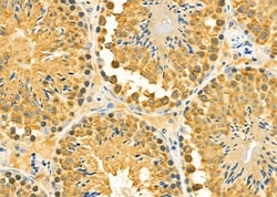Invitrogen MGRN1 Polyclonal Antibody 100 &mu;L; Unconjugated:Antibodies,