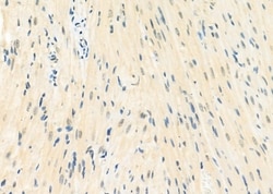 Invitrogen MGRN1 Polyclonal Antibody 100 &mu;L; Unconjugated:Antibodies,