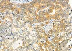 Invitrogen MGRN1 Polyclonal Antibody 100 &mu;L; Unconjugated:Antibodies,