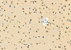 Invitrogen MGRN1 Polyclonal Antibody 100 &mu;L; Unconjugated:Antibodies,