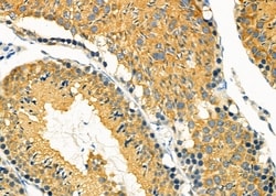 Invitrogen MGRN1 Polyclonal Antibody 100 &mu;L; Unconjugated:Antibodies,