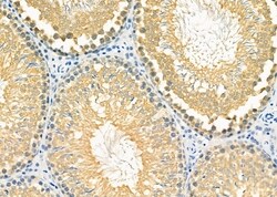Invitrogen MGRN1 Polyclonal Antibody 100 &mu;L; Unconjugated:Antibodies,
