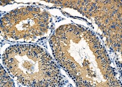 Invitrogen MGRN1 Polyclonal Antibody 100 &mu;L; Unconjugated:Antibodies,