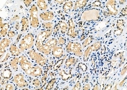 Invitrogen SEC24A Polyclonal Antibody 100 &mu;L; Unconjugated:Antibodies,