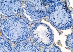 Invitrogen SEC24A Polyclonal Antibody 100 &mu;L; Unconjugated:Antibodies,
