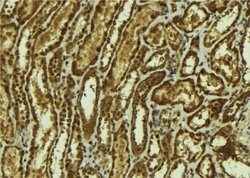 SMOX Polyclonal Antibody, Invitrogen 100 &mu;L; Unconjugated, Quantity: