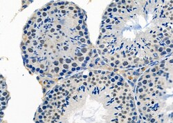 Invitrogen SMOX Polyclonal Antibody 100 &mu;L; Unconjugated:Antibodies,