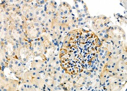 Invitrogen SMOX Polyclonal Antibody 100 &mu;L; Unconjugated:Antibodies,