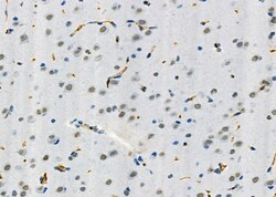 Invitrogen SMOX Polyclonal Antibody 100 &mu;L; Unconjugated:Antibodies,