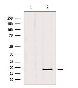 Invitrogen SRP14 Polyclonal Antibody 100 &mu;L; Unconjugated:Antibodies,