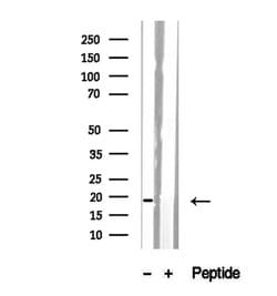 Invitrogen SRP14 Polyclonal Antibody 100 &mu;L; Unconjugated:Antibodies,