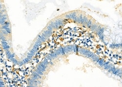 Invitrogen SULT1C2 Polyclonal Antibody 100 &mu;L; Unconjugated:Antibodies,
