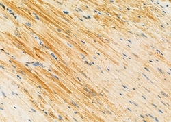 Invitrogen SULT1C2 Polyclonal Antibody 100 &mu;L; Unconjugated:Antibodies,