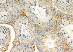 Invitrogen SULT1C2 Polyclonal Antibody 100 &mu;L; Unconjugated:Antibodies,