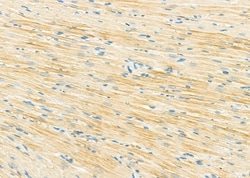 Invitrogen SULT1C2 Polyclonal Antibody 100 &mu;L; Unconjugated:Antibodies,