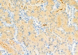 Invitrogen SULT1C2 Polyclonal Antibody 100 &mu;L; Unconjugated:Antibodies,