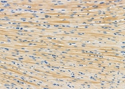 Invitrogen SULT1C2 Polyclonal Antibody 100 &mu;L; Unconjugated:Antibodies,