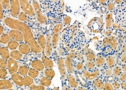 Invitrogen SULT1C2 Polyclonal Antibody 100 &mu;L; Unconjugated:Antibodies,