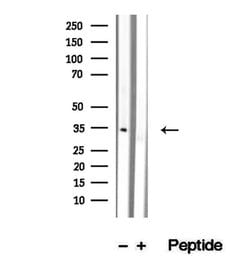 Invitrogen SULT1C2 Polyclonal Antibody 100 &mu;L; Unconjugated:Antibodies,
