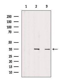 Invitrogen SULT1C2 Polyclonal Antibody 100 &mu;L; Unconjugated:Antibodies,
