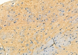 Invitrogen Syndecan 3 Polyclonal Antibody 100 &mu;L; Unconjugated:Antibodies,