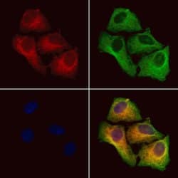 Invitrogen TMOD1 Polyclonal Antibody 100 &mu;L; Unconjugated:Antibodies,
