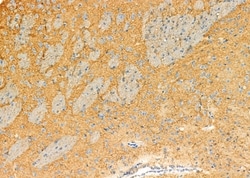 Invitrogen TMOD1 Polyclonal Antibody 100 &mu;L; Unconjugated:Antibodies,