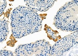 Invitrogen TMOD1 Polyclonal Antibody 100 &mu;L; Unconjugated:Antibodies,