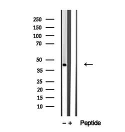 Invitrogen TMOD1 Polyclonal Antibody 100 &mu;L; Unconjugated:Antibodies,