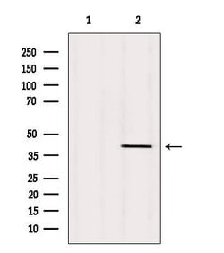 Invitrogen TMOD1 Polyclonal Antibody 100 &mu;L; Unconjugated:Antibodies,