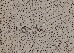 Invitrogen TNP1 Polyclonal Antibody 100 &mu;L; Unconjugated:Antibodies,