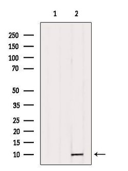 Invitrogen TNP1 Polyclonal Antibody 100 &mu;L; Unconjugated:Antibodies,