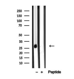 Invitrogen D4-GDI Polyclonal Antibody 100 &mu;L; Unconjugated:Antibodies,