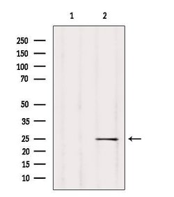 Invitrogen D4-GDI Polyclonal Antibody 100 &mu;L; Unconjugated:Antibodies,