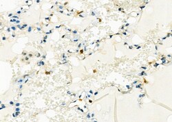 Invitrogen D4-GDI Polyclonal Antibody 100 &mu;L; Unconjugated:Antibodies,