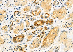 Invitrogen SLC10A2 Polyclonal Antibody 100 &mu;L; Unconjugated:Antibodies,