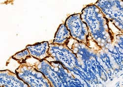 Invitrogen SLC10A2 Polyclonal Antibody 100 &mu;L; Unconjugated:Antibodies,