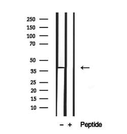 Invitrogen SLC10A2 Polyclonal Antibody 100 &mu;L; Unconjugated:Antibodies,