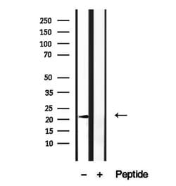 Invitrogen ARL6 Polyclonal Antibody 100 &mu;L; Unconjugated:Antibodies,