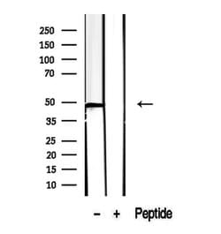 Invitrogen CCBL1 Polyclonal Antibody 100 &mu;L; Unconjugated:Antibodies,