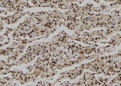 Invitrogen CNOT10 Polyclonal Antibody 100 &mu;L; Unconjugated:Antibodies,