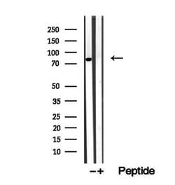 Invitrogen CNOT10 Polyclonal Antibody 100 &mu;L; Unconjugated:Antibodies,