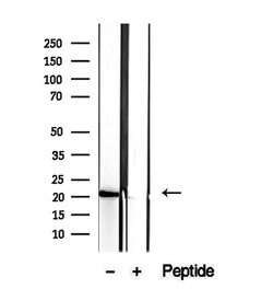 Invitrogen CNPY2 Polyclonal Antibody 100 &mu;L; Unconjugated:Antibodies,