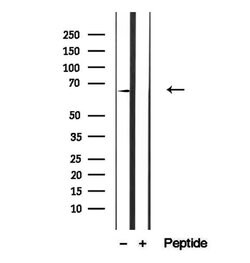 Invitrogen CAT1 Polyclonal Antibody 100 &mu;L; Unconjugated:Antibodies,