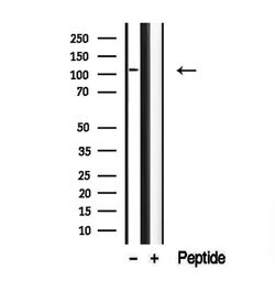 Invitrogen DAAM1 Polyclonal Antibody 100 &mu;L; Unconjugated:Antibodies,