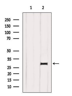 Invitrogen DIO1 Polyclonal Antibody 100 &mu;L | Buy Online | Invitrogen&trade; | Fisher Scientific